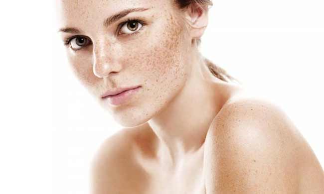Treatment for Dark Spots on Face